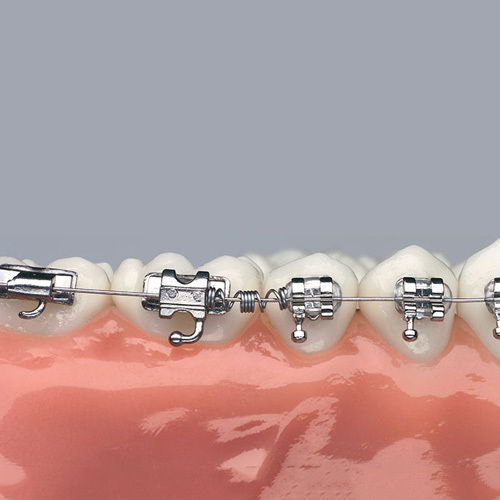 DynaFlex дистализирующая пружина NiTi Distalizing Spring